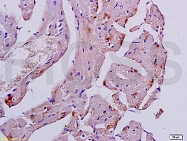 bs-1026R - Desmin