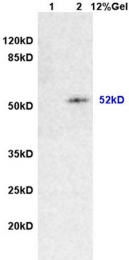 bs-1026R - Desmin