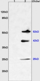 bs-1065R - TMEM8B