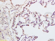 bs-1109R - IQGAP1