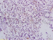 bs-1185R - TRAF3 / CRAF1