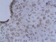 bs-1191R - Interleukin-2 / IL2