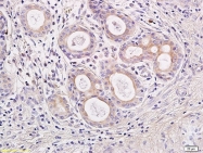 bs-1193R - Interleukin-23 alpha / IL23A
