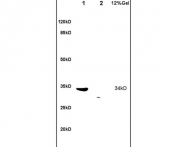 bs-1202R - TRADD