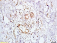 bs-1210R - BRCA2 / FANCD1