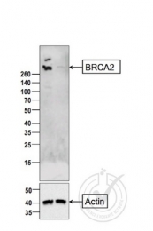 bs-1210R - BRCA2 / FANCD1