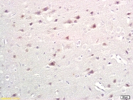 bs-1215R - Tryptophan 5-hydroxylase 1 (TPH1)