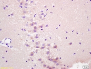 bs-1234R - RASSF1