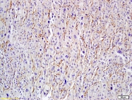 bs-1235R - HYAL1 / Hyaluronidase-1