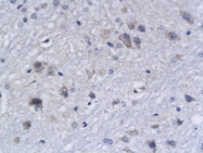 bs-1284R - Bcl-2-like 7