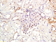 bs-1287R - NFKBIA / IKBA