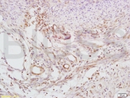 bs-1295R - Defensin beta 2