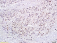 bs-1346R - Tumor protein p73 (TP73)