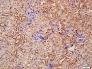 bs-1353R - Beclin-1