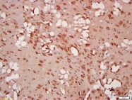 bs-1353R - Beclin-1