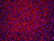 bs-1353R - Beclin-1