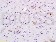 bs-1365R - TSG101