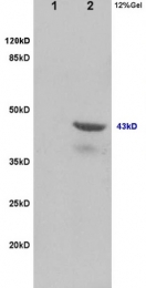 bs-1365R - TSG101