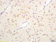 bs-1387R - Heat shock protein 105 / HSP105