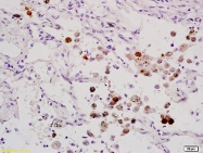 bs-1398R - ELK1