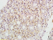 bs-1443R - TER ATPase / VCP