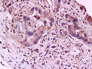 bs-1460R - Interleukin-23 receptor / IL23R