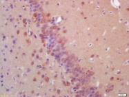bs-1493R - EIF2AK2 / PKR