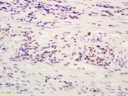 bs-1531R - ATF4
