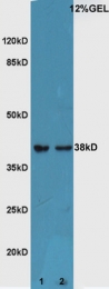 bs-1531R - ATF4