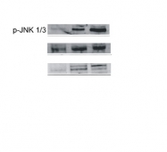 bs-1640R - JNK1/2/3