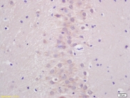 bs-1718R - ATP7B
