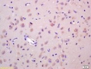 bs-1739R - WNT1