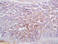 bs-1763R - EPHA1