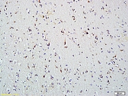 bs-1813R - HDAC2