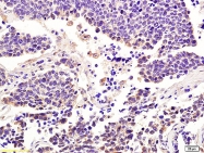 bs-1816R - Integrin alpha-7 / ITGA7