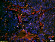 bs-1816R - Integrin alpha-7 / ITGA7