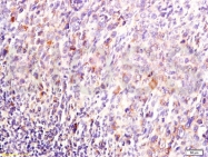 bs-1851R - DUSP1 / MKP1