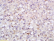 bs-1949R - WEE1 / Wee1-like protein kinase
