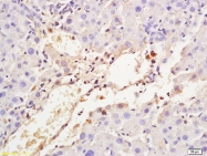 bs-2052R - Transferrin