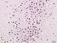 bs-2081R - Tumor necrosis factor (TNF-alpha)
