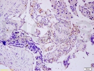 bs-2081R - Tumor necrosis factor (TNF-alpha)