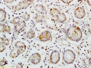 bs-2101R - CD248 / TEM1
