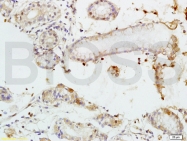 bs-2101R - CD248 / TEM1