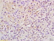 bs-2343R - Erythropoietin / EPO