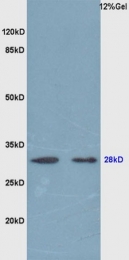 bs-2343R - Erythropoietin / EPO