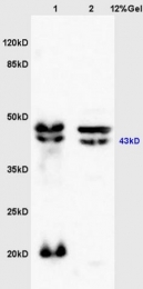 bs-2422R - BDKRB2