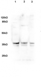 bs-2423R - DLK1