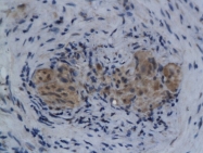 bs-2437R - Autotaxin / ENPP2