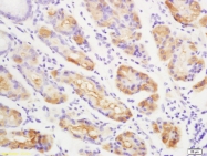 bs-2437R - Autotaxin / ENPP2