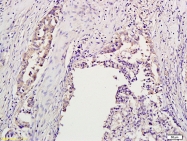 bs-2445R - Aurora kinase B